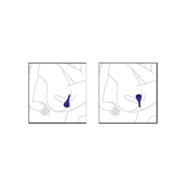 Vibrating Ring Ping Fuchsia - Image 6