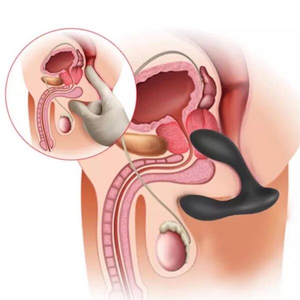 Brett Prostate Massager Remote Control USB Liquid Silicone - Image 11