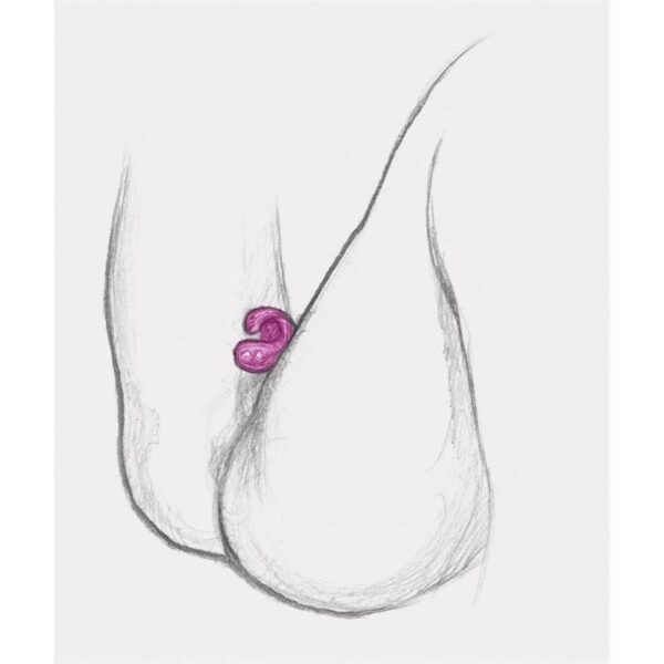 Gring XL Sweet Raspberry - Image 8